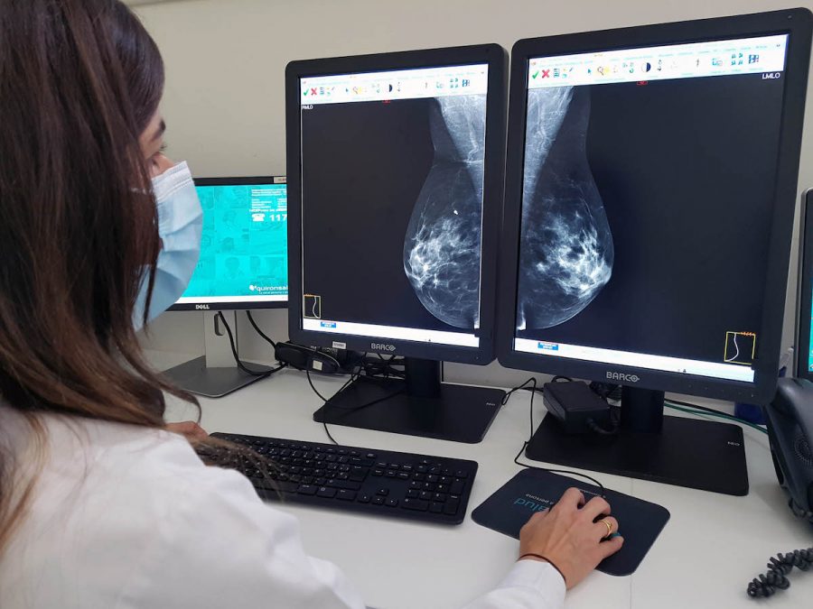 La Junta de Andalucía rebaja a 45 años la edad de entrada en el programa de cribado de cáncer de mama - mamografia quironsalud marbella La mamografía es una de las pruebas más fiables para detectar el cáncer de mama.