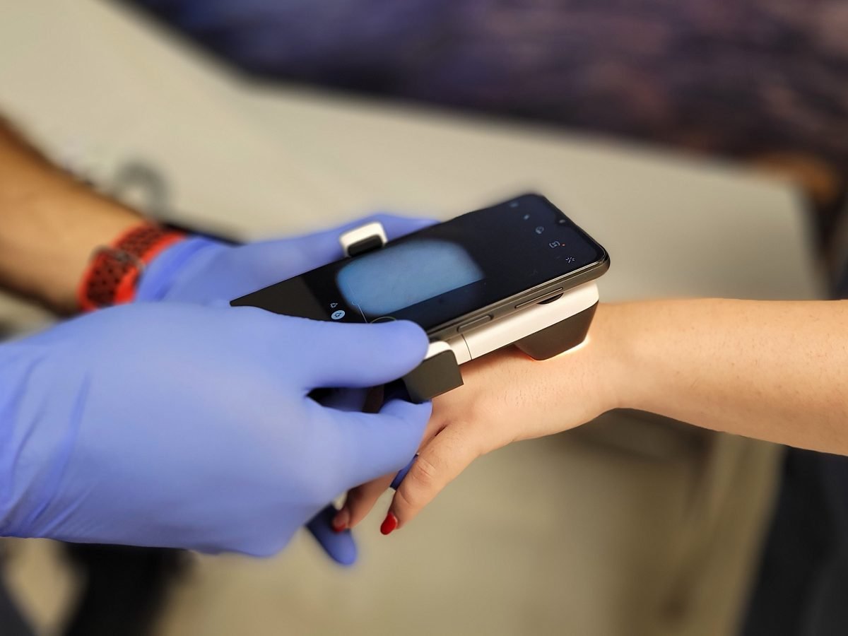 Identificar y prevenir el cáncer de piel: el más común pero el más fácil de curar si se pilla a tiempo - teledermatologia quironsalud Teledermatología en Quirónsalud Marbella.