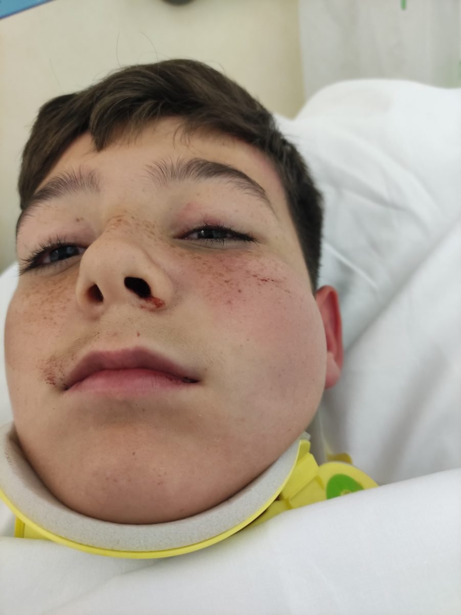 Una madre denuncia el trato de un vecino a su hijo: "le ha dado un golpe que le ha dejado inconsciente" - IMG 20231110 202015 Una madre denuncia el trato de un vecino a su hijo: "le ha dado un golpe que le ha dejado inconsciente" - IMG 20231110 202015