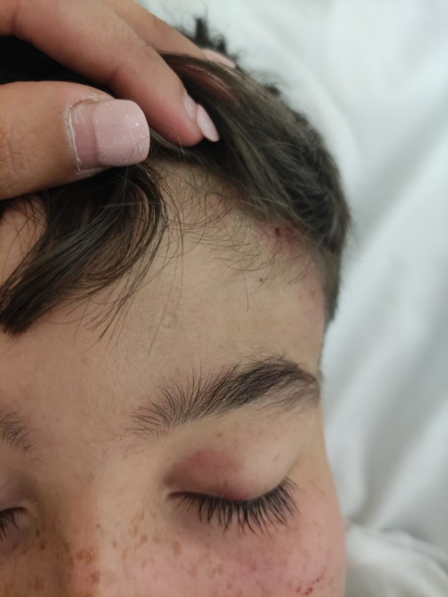 Una madre denuncia el trato de un vecino a su hijo: "le ha dado un golpe que le ha dejado inconsciente" - IMG 20231110 202326 Una madre denuncia el trato de un vecino a su hijo: "le ha dado un golpe que le ha dejado inconsciente" - IMG 20231110 202326