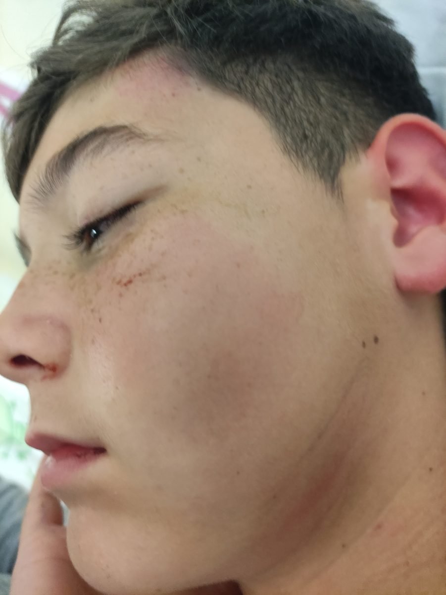 Una madre denuncia el trato de un vecino a su hijo: "le ha dado un golpe que le ha dejado inconsciente" - IMG 20231110 202337 Una madre denuncia el trato de un vecino a su hijo: "le ha dado un golpe que le ha dejado inconsciente" - IMG 20231110 202337