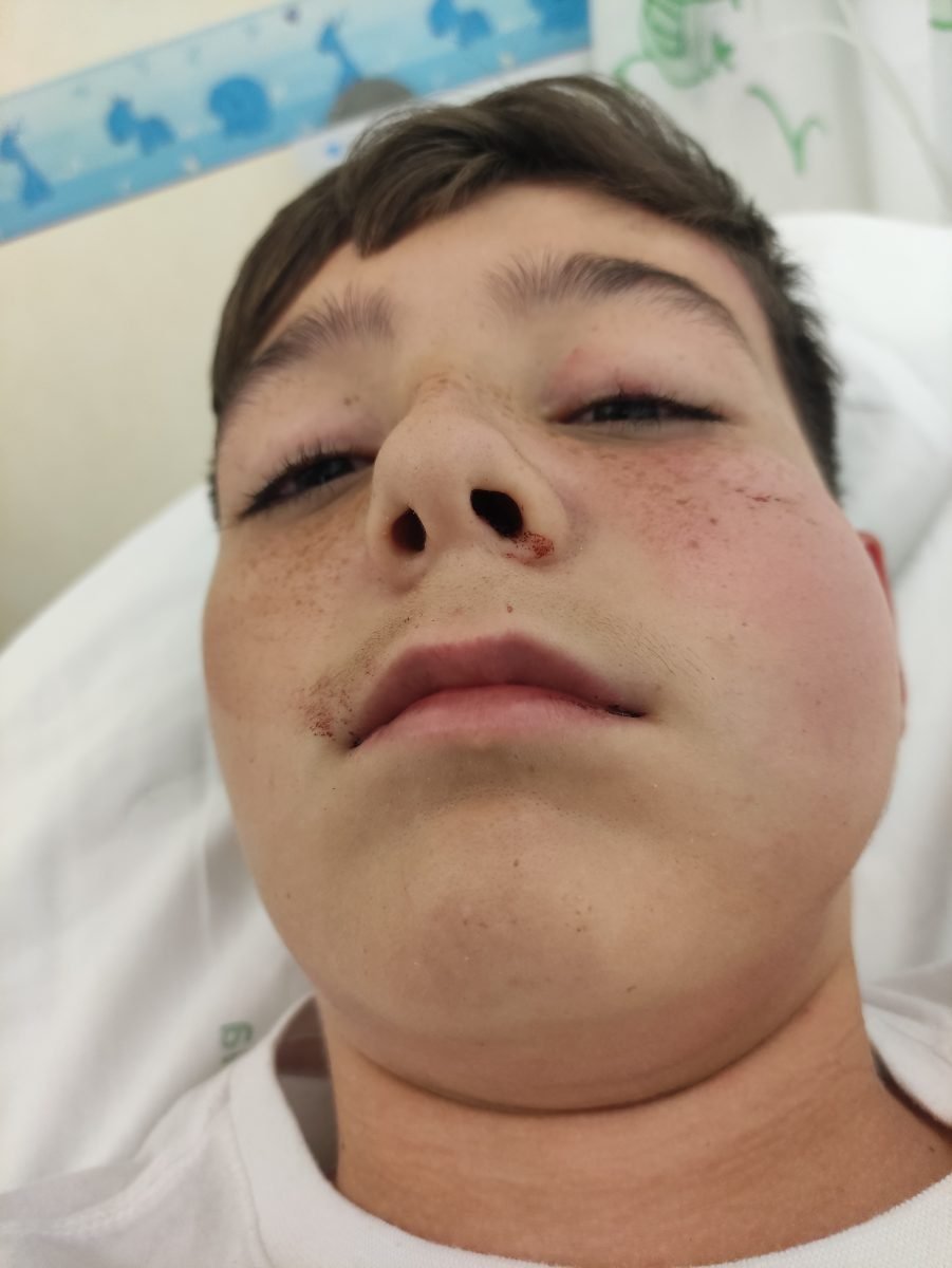 Una madre denuncia el trato de un vecino a su hijo: "le ha dado un golpe que le ha dejado inconsciente" - IMG 20231110 202347 Una madre denuncia el trato de un vecino a su hijo: "le ha dado un golpe que le ha dejado inconsciente" - IMG 20231110 202347