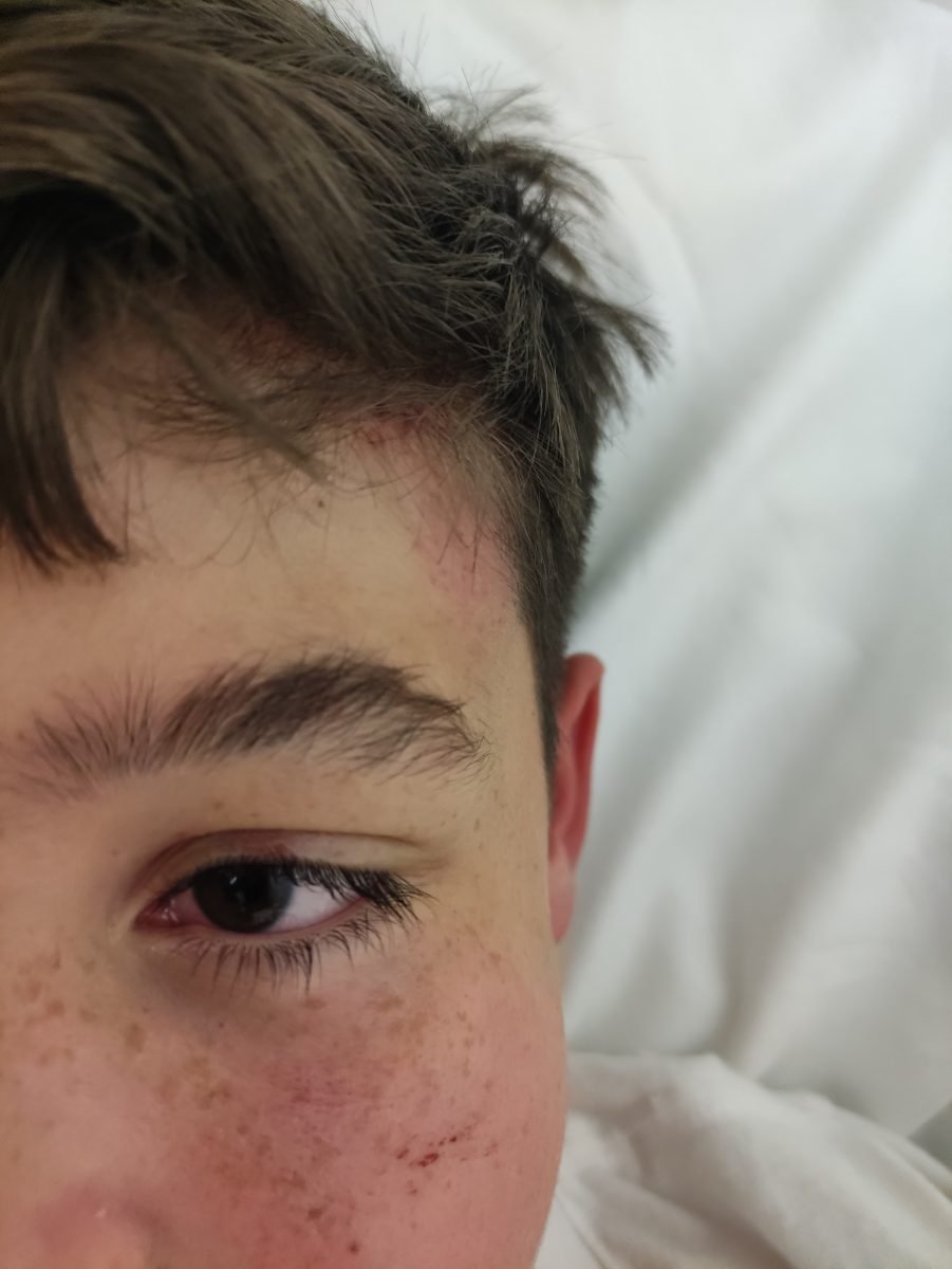 Una madre denuncia el trato de un vecino a su hijo: "le ha dado un golpe que le ha dejado inconsciente" - IMG 20231110 202449 Una madre denuncia el trato de un vecino a su hijo: "le ha dado un golpe que le ha dejado inconsciente" - IMG 20231110 202449