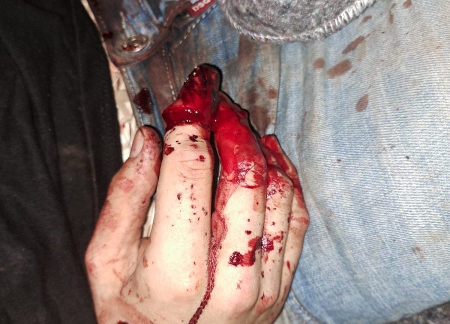 Una red de narcos tortura y somete a un detector de mentiras a un socio por un robo - 20231222 foto 1 1 e1703264217153 Una red de narcos tortura y somete a un detector de mentiras a un socio por un robo - 20231222 foto 1 1 e1703264217153