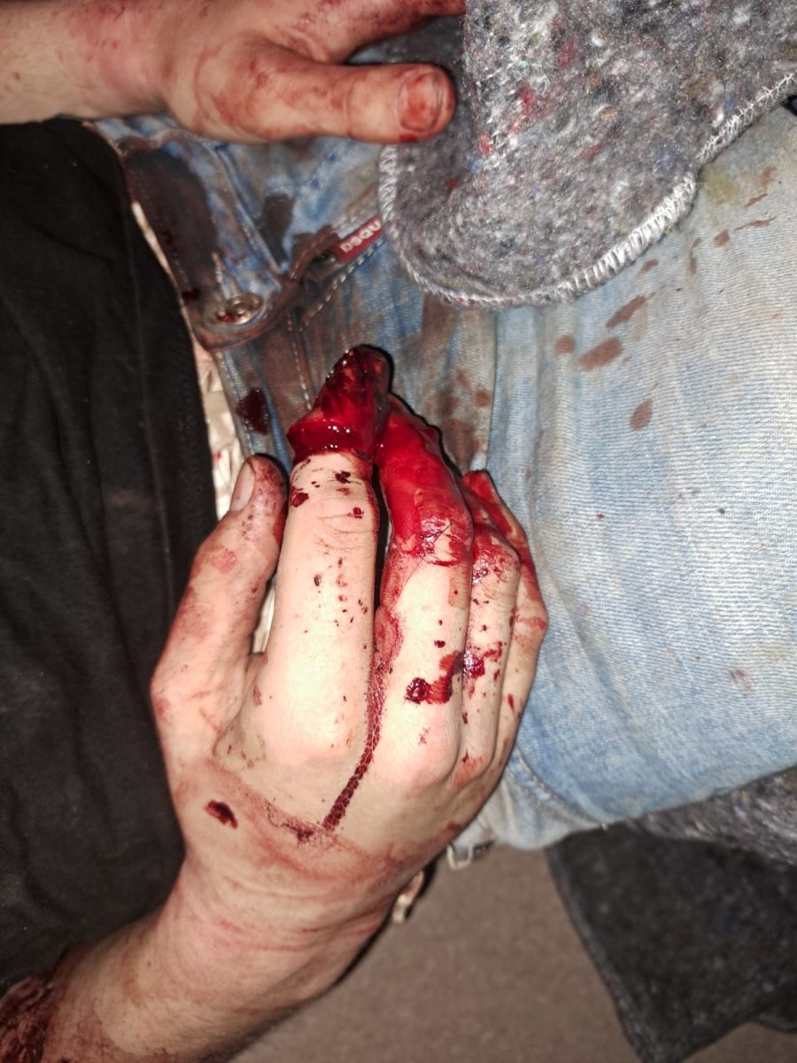 Una red de narcos tortura y somete a un detector de mentiras a un socio por un robo - 20231222 foto 1 1 Una red de narcos tortura y somete a un detector de mentiras a un socio por un robo - 20231222 foto 1 1