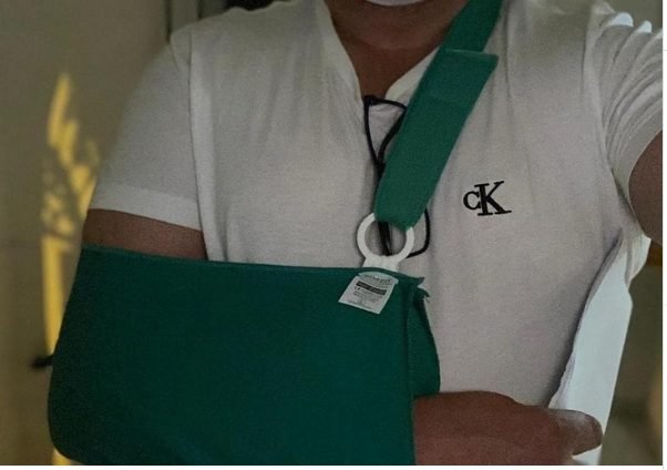 Condenado a 18 meses de prisión por romper el hombro a un policía al intentar detener una agresión en Benalmádena - Captura 1 Policía local agredido./ MSQ