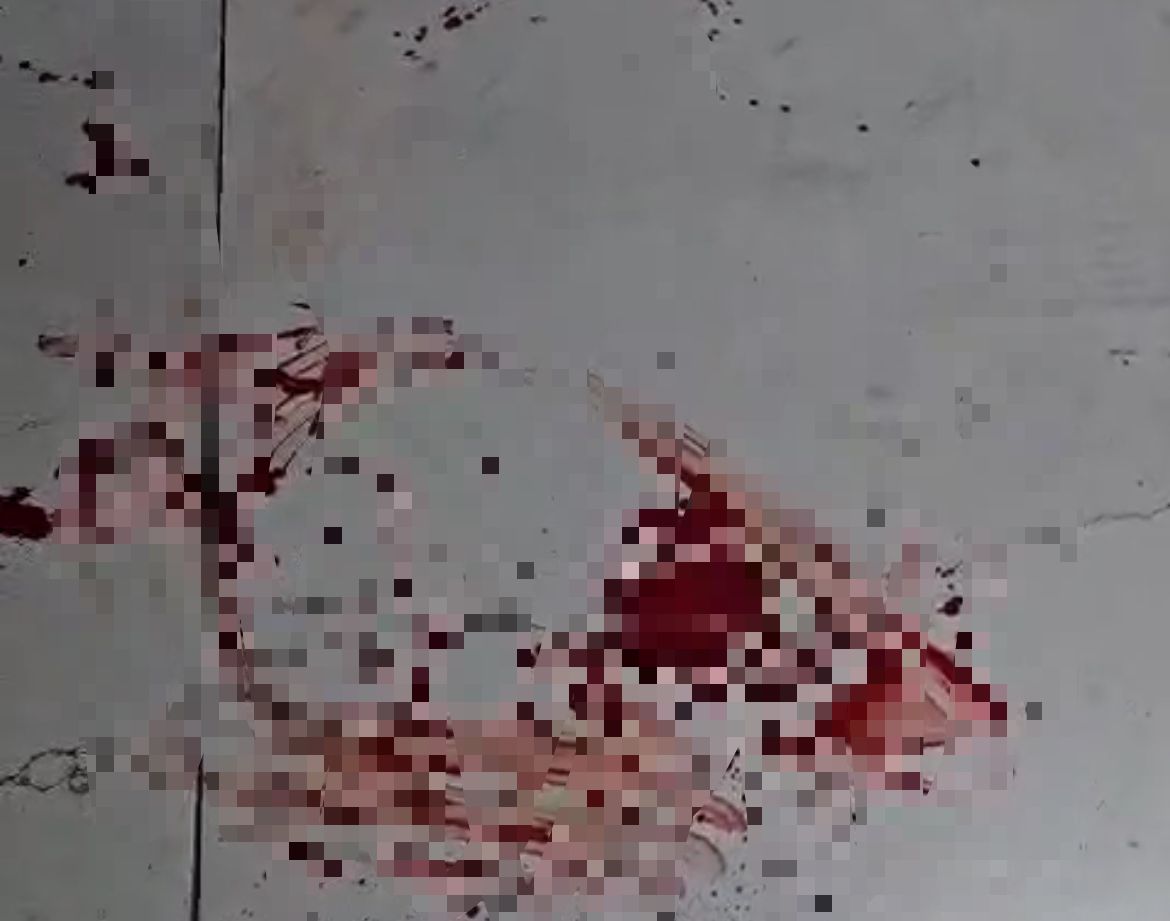 Apuñala hasta siete veces al exmarido de su pareja actual en una urbanización de Estepona - WhatsApp Image 2024 10 02 at 10.20.49 Imagen de un vídeo realizado en la zona del apuñalamiento. / Área