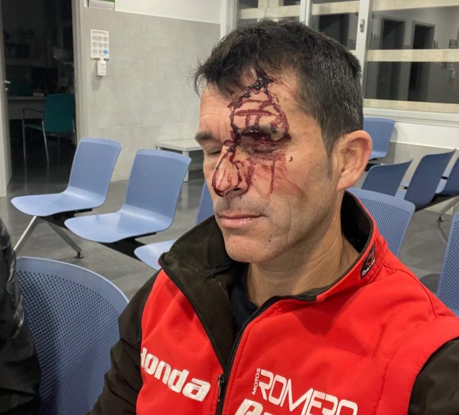 Una okupa agrede con un martillo a un vecino en Manilva - WhatsApp Image 2025 01 17 at 14.27.41 e1737121382644 Una okupa agrede con un martillo a un vecino en Manilva - WhatsApp Image 2025 01 17 at 14.27.41 e1737121382644