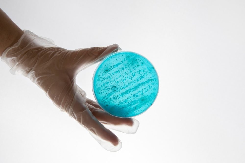 Andalucía refuerza la vacunación tras detectar 47 casos de sarampión en 2025 - sarampion Andalucía refuerza la vacunación tras detectar 47 casos de sarampión en 2025 - sarampion