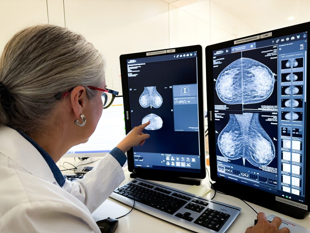 HC Marbella revoluciona el diagnóstico por imagen con inteligencia artificial en mamografía, TC y resonancia magnética - 02 HC Marbella revoluciona el diagnóstico por imagen con inteligencia artificial en mamografía, TC y resonancia magnética