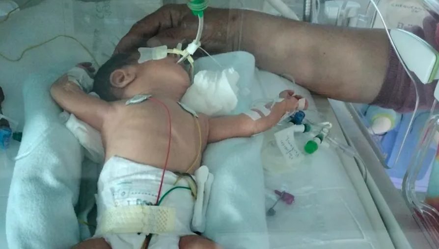 La lucha por la vida de Neelu: el camino de una bebé prematura en Benahavís - Captura de pantalla 2025 04 21 094610 La lucha por la vida de Neelu: el camino de una bebé prematura en Benahavís - Captura de pantalla 2025 04 21 094610