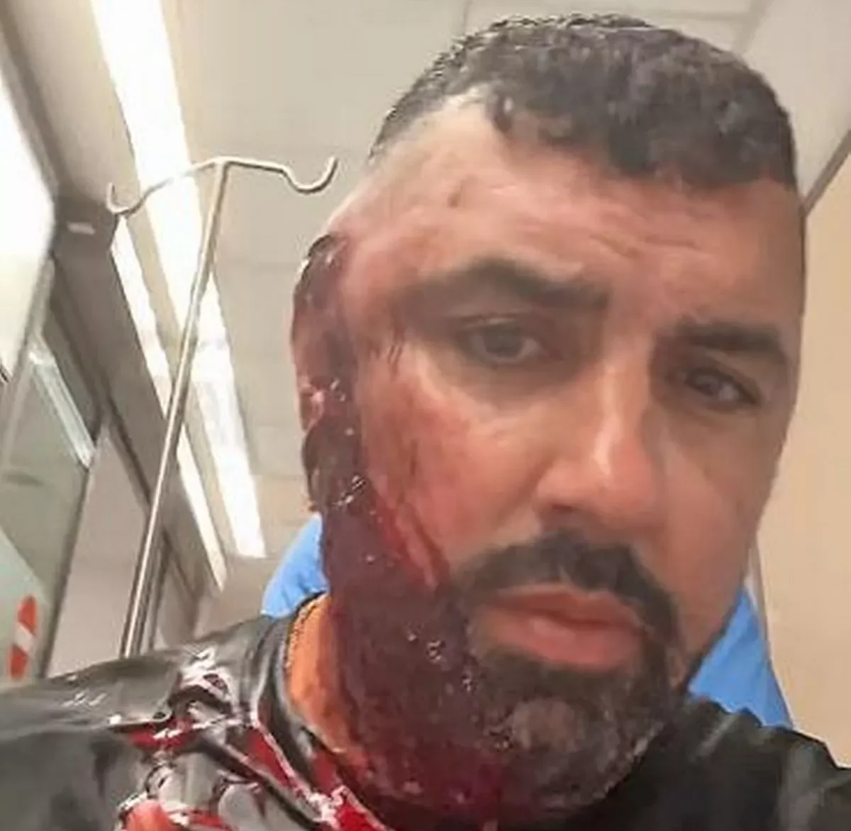 Golpean a un influencer británico con palos de golf por mofarse del asesinato de dos mafiosos en Fuengirola - Sam Walker e1751974011272 Sam Walker